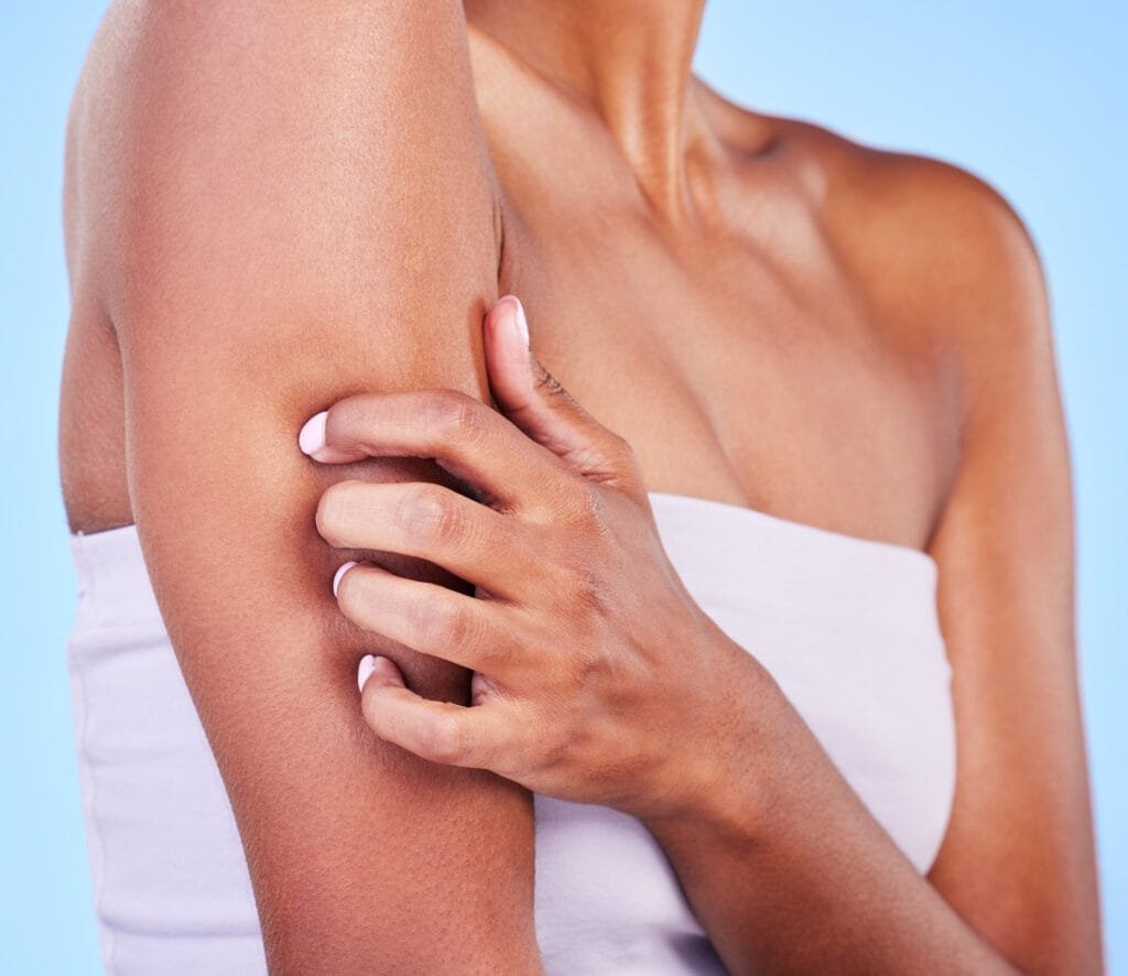 Causes et symptômes de la dermatillomanie